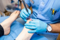 Safety and Effectiveness of Laser Treatment for Toenail Fungus